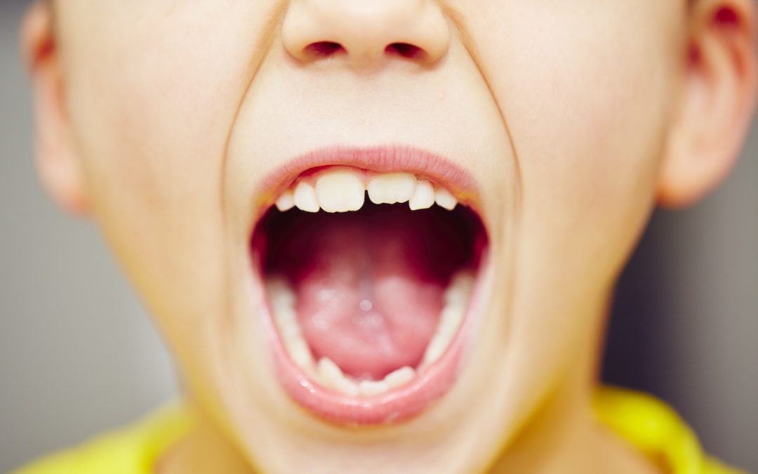 Fluorizarea dentară